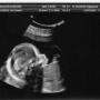 Thomas Roy Photo 17