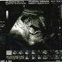 Cassandra Richardson Photo 22