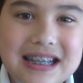 Matthew Brace Photo 28
