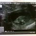 Baby Smith Photo 30