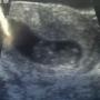 Elizabeth Wagner Photo 17