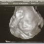 Frances Gross Photo 21
