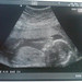 Baby Smith Photo 24