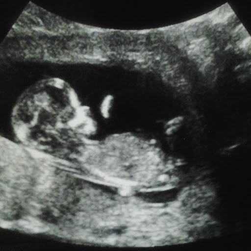 Baby Smith Photo 18