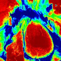 June Fuller Photo 13