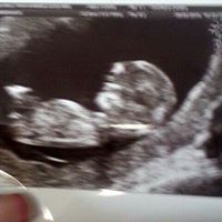 Teresa Doherty Photo 18