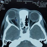 Nancy Frederick Photo 11