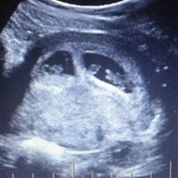 Geoffrey James Photo 35