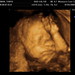 Marcus Norman Photo 22