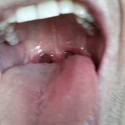 Jason Hinton Photo 42