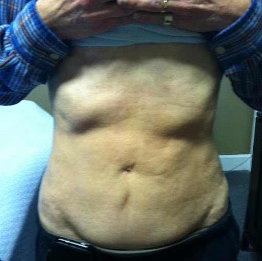 Cody Calhoun Photo 11