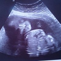 Teresa Hoover Photo 34