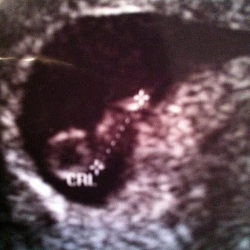 Victoria Blevins Photo 28