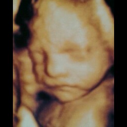 Laura Vickers Photo 35