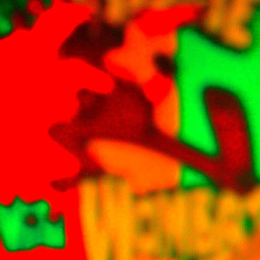 Anthony Calderone Photo 1