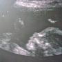Keith Paul Photo 45