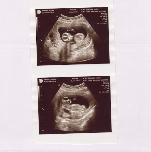 Benjamin Williams Photo 38