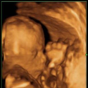 Joseph Morrow Photo 30