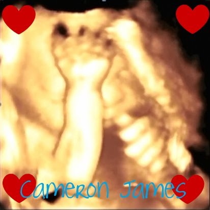 Tanya Watson Photo 22