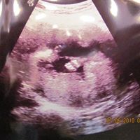 Angela Bean Photo 22