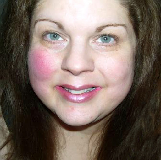 Anne Frederick Photo 24