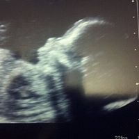 Elizabeth Loveless Photo 10