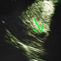 Janet Grimes Photo 15