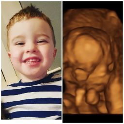 Samantha Kerr Photo 30