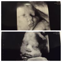 Karen Cummins Photo 21