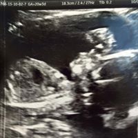 Candice Martell Photo 4