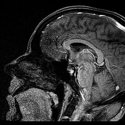 Lee Mcdaniel Photo 43