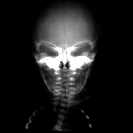 Frank Robins Photo 16