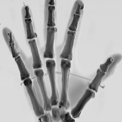 Chris Vance Photo 42