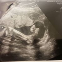 Christina Colvin Photo 13