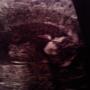 Brittany Jahn Photo 2