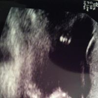 Deborah Dutton Photo 11