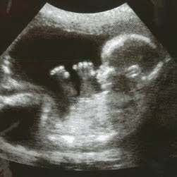 Cathy Galloway Photo 4