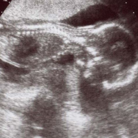 Henry Harvey Photo 38