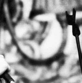 Katie Stack Photo 35