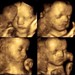 Harrison Little Photo 16