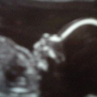 Aaron Ruffin Photo 30