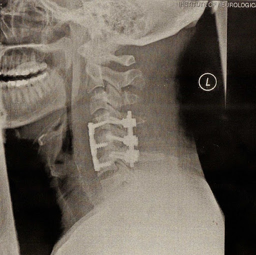 Ben Phillips Photo 24