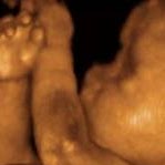 Thomas Donovan Photo 57 Thomas Donovan Photo 57