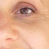 Anne Morris Photo 22