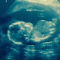 Suzanne Creech Photo 13