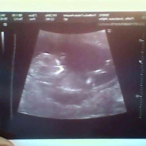 David Partin Photo 41