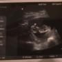 Lisa Arndt Photo 23