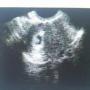 Alicia Case Photo 8