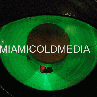 Ron Pearson Photo 13