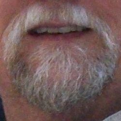 Ginger Beard Photo 20